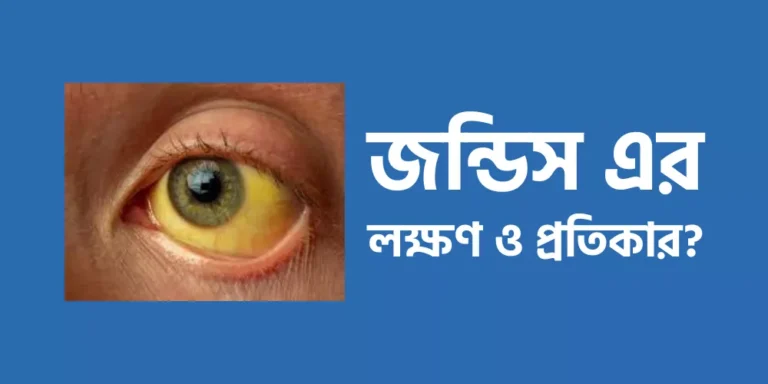 জন্ডিস এর লক্ষণ ও প্রতিকার?